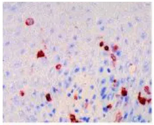 Anti-Fc epsilon R1 alpha antibody [CRA1] used in IHC (Frozen sections) (IHC-Fr). GTX00711