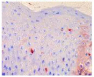 Anti-Fc epsilon R1 alpha antibody [CRA2] used in IHC (Frozen sections) (IHC-Fr). GTX00712