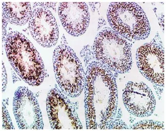 Anti-Haploid sperm cell-specific antigen antibody [TRA54] used in IHC (Paraffin sections) (IHC-P). GTX00716