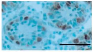 Anti-Germ cell-specific antigen antibody [TRA98] used in IHC (Frozen sections) (IHC-Fr). GTX00717