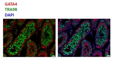 Anti-Germ cell-specific antigen antibody [TRA98] used in IHC (Paraffin sections) (IHC-P). GTX00717