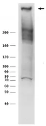 Anti-RANBP2 antibody used in Western Blot (WB). GTX00729