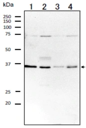 Anti-RRAGA antibody used in Western Blot (WB). GTX00730