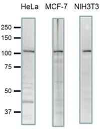 Anti-SCYL2 antibody used in Western Blot (WB). GTX00732