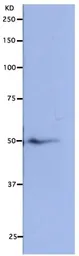 Anti-NUF2 antibody used in Western Blot (WB). GTX00733