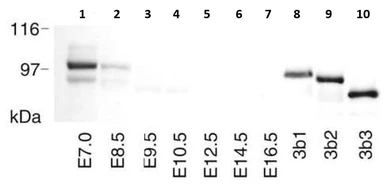 Anti-DNMT3B antibody used in Western Blot (WB). GTX00735