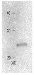 Anti-CBX1 / HP1 beta antibody used in Western Blot (WB). GTX00736