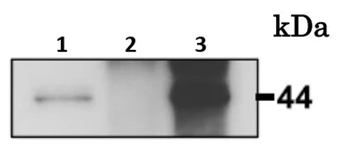 Anti-Calreticulin 3 antibody used in Immunoprecipitation (IP). GTX00741