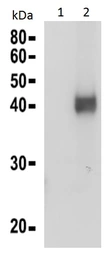 Anti-Calreticulin 3 antibody used in Western Blot (WB). GTX00741