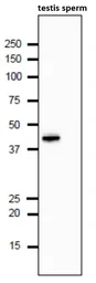 Anti-Calreticulin 3 antibody used in Western Blot (WB). GTX00741