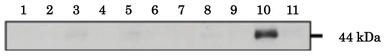 Anti-Calreticulin 3 antibody used in Western Blot (WB). GTX00741