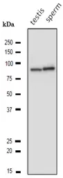 Anti-Calnexin antibody used in Western Blot (WB). GTX00742