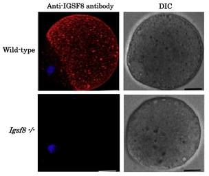 Anti-IGSF8 antibody used in Immunocytochemistry/ Immunofluorescence (ICC/IF). GTX00745