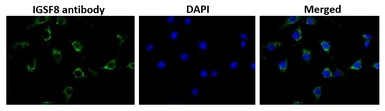 Anti-IGSF8 antibody used in Immunocytochemistry/ Immunofluorescence (ICC/IF). GTX00745