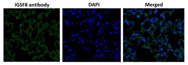 Anti-IGSF8 antibody used in IHC (Paraffin sections) (IHC-P). GTX00745