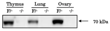 Anti-IGSF8 antibody used in Western Blot (WB). GTX00745