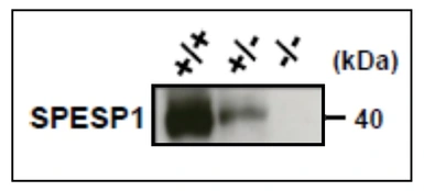 Anti-SPESP1 antibody used in Western Blot (WB). GTX00750