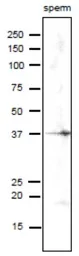 Anti-SPESP1 antibody used in Western Blot (WB). GTX00750