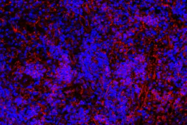 Anti-NLRP3 antibody used in IHC (Paraffin sections) (IHC-P). GTX00763