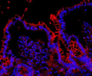 Anti-NLRP3 antibody used in IHC (Paraffin sections) (IHC-P). GTX00763