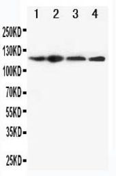 Anti-NLRP3 antibody used in Western Blot (WB). GTX00763