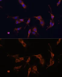 Anti-IQGAP1 antibody used in Immunocytochemistry/ Immunofluorescence (ICC/IF). GTX00764