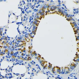 Anti-IQGAP1 antibody used in IHC (Paraffin sections) (IHC-P). GTX00764