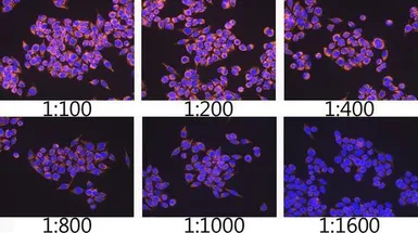 Anti-TOMM20 antibody [GT1136] used in Immunocytochemistry/ Immunofluorescence (ICC/IF). GTX00773