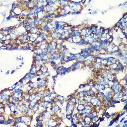 Anti-TOMM20 antibody [GT1136] used in IHC (Paraffin sections) (IHC-P). GTX00773