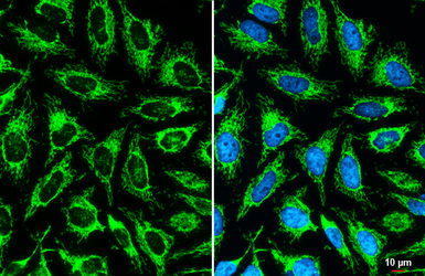 Anti-TOMM20 antibody [GT1136] used in Immunocytochemistry/ Immunofluorescence (ICC/IF). GTX00773