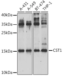 Anti-Cystatin SN antibody used in Western Blot (WB). GTX00786