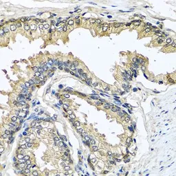 Anti-Cystatin SN antibody used in IHC (Paraffin sections) (IHC-P). GTX00786