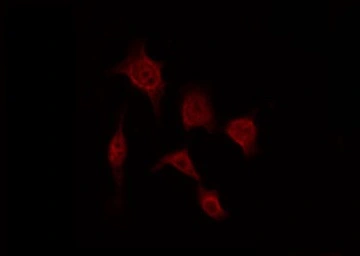 Anti-Claudin 5 antibody used in Immunocytochemistry/ Immunofluorescence (ICC/IF). GTX00796