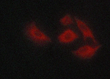 Anti-Claudin 5 antibody used in Immunocytochemistry/ Immunofluorescence (ICC/IF). GTX00796