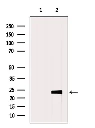 Anti-Claudin 5 antibody used in Western Blot (WB). GTX00796