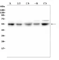 Anti-RBMS3 antibody used in Western Blot (WB). GTX00828