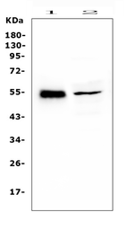 Anti-RBMS3 antibody used in Western Blot (WB). GTX00828