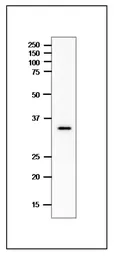 Anti-Clostridium perfringens enterotoxin (CPE) antibody used in Western Blot (WB). GTX00879