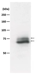 Anti-RAD18 antibody used in Western Blot (WB). GTX00886