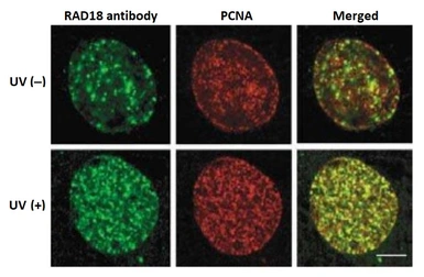 Anti-RAD18 antibody used in Immunocytochemistry/ Immunofluorescence (ICC/IF). GTX00886