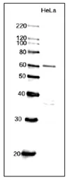 Anti-CDC6 antibody used in Western Blot (WB). GTX00896