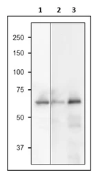 Anti-Sulfite Reductase antibody used in Western Blot (WB). GTX00926