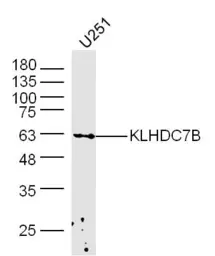 Anti-KLHDC7B antibody used in Western Blot (WB). GTX00938