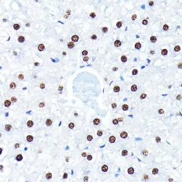 Anti-ELAVL1 / HuR antibody [GT1182] used in IHC (Paraffin sections) (IHC-P). GTX00944