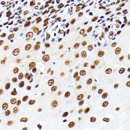 Anti-ELAVL1 / HuR antibody [GT1182] used in IHC (Paraffin sections) (IHC-P). GTX00944