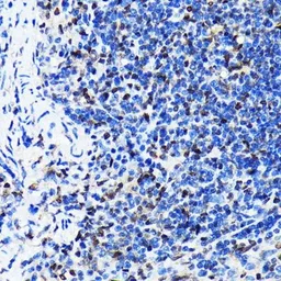 Anti-ELAVL1 / HuR antibody [GT1182] used in IHC (Paraffin sections) (IHC-P). GTX00944