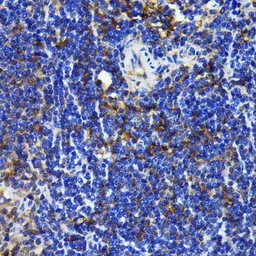 Anti-NFkB p65 antibody [GT1185] used in IHC (Paraffin sections) (IHC-P). GTX00947