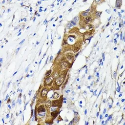 Anti-NFkB p65 antibody [GT1185] used in IHC (Paraffin sections) (IHC-P). GTX00947