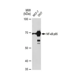 Anti-NFkB p65 antibody [GT1185] used in Western Blot (WB). GTX00947