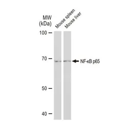 Anti-NFkB p65 antibody [GT1185] used in Western Blot (WB). GTX00947